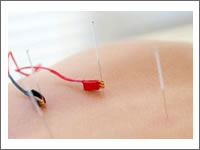 ELECTROACUPUNCTURE front page